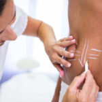 CoolSculpting vs Fat Freezing