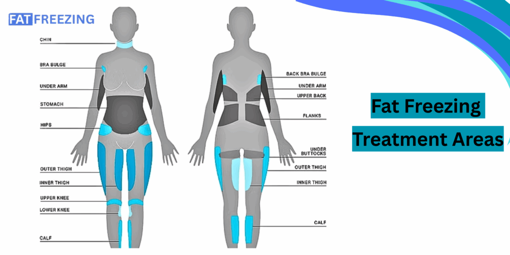 Fat Freezing Target Areas