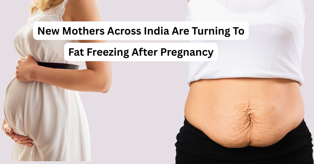 Why Fat Freezing Is Becoming the Favourite Choice of New Moms for Belly Fat Reduction 2 Fat Freezing After Pregnancy So Effective