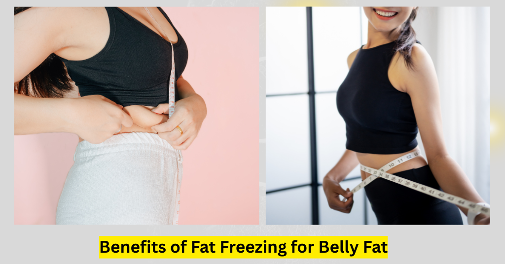Benefits of Fat Freezing for Belly Fat 