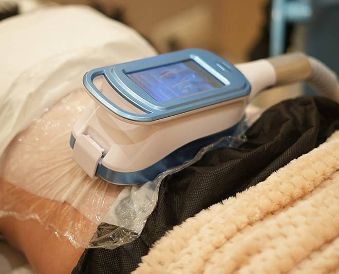Does Fat Freezing Treatment in Mumbai Really Work? Real Results, Science, and What to Expect 2 fat freezee