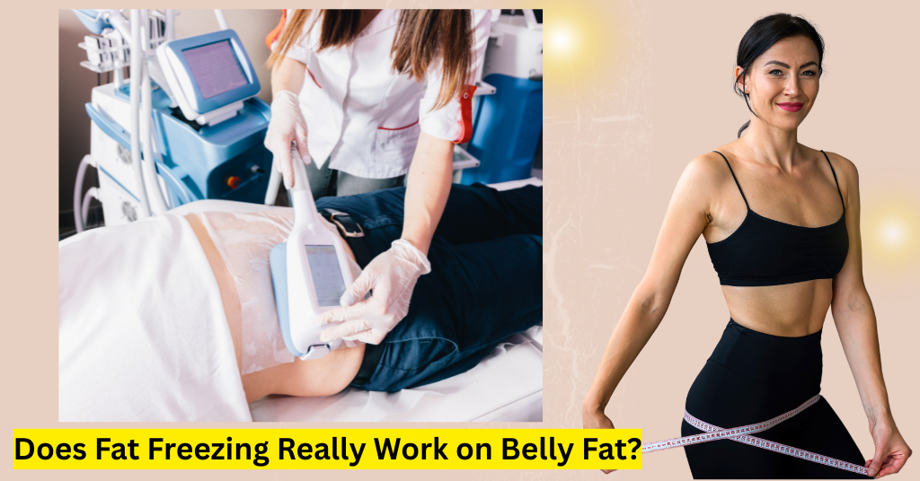 Fat Freezing on Belly Fat