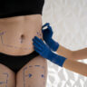 front view doctor drawing woman s body scaled