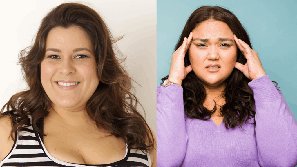 Ideal Candidates for CoolSculpting Face