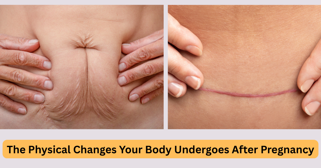 Why Fat Freezing Is Becoming the Favourite Choice of New Moms for Belly Fat Reduction 1 fat freezing results phases