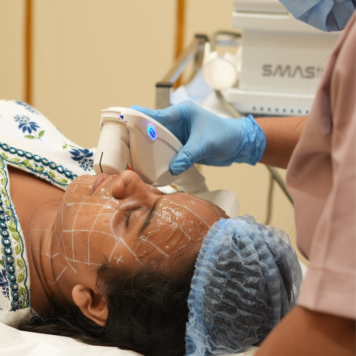 hifu treatment