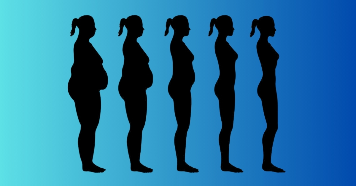 fat freeze body sculpting