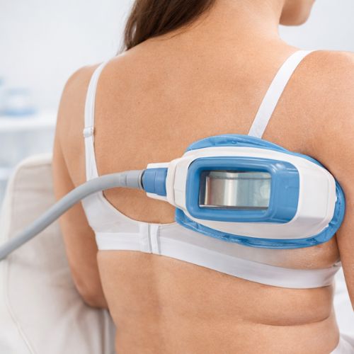Back Fat Freezing
