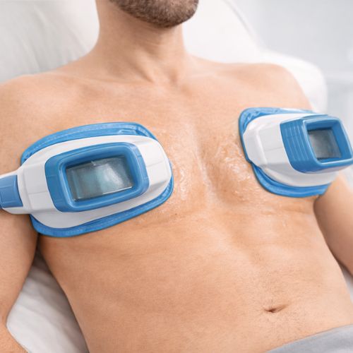 Male Chest Fat Freezing
