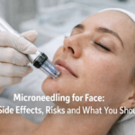 Microneedling for Face