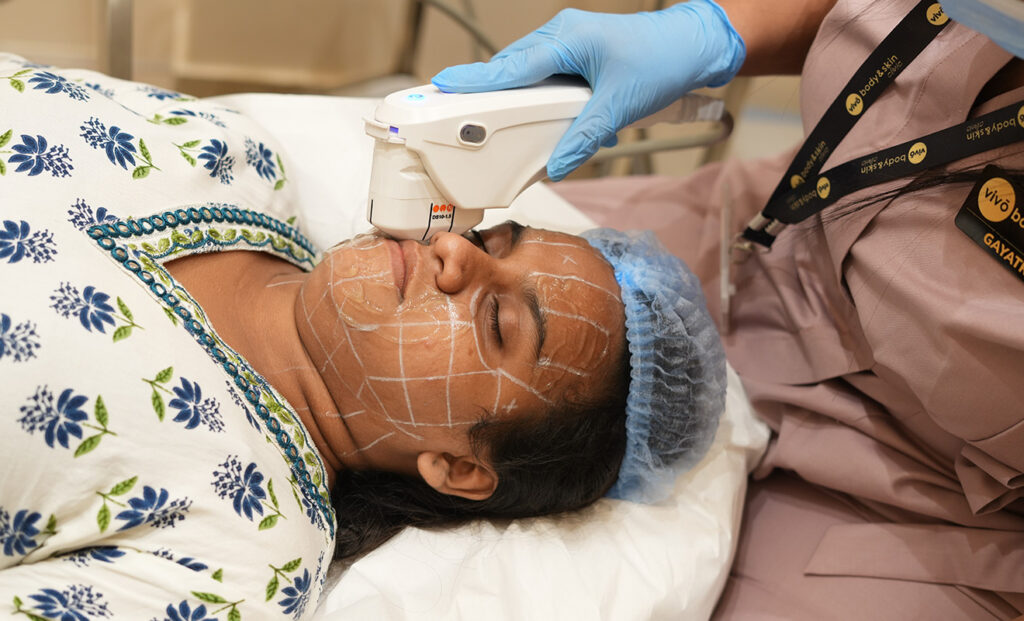 HIFU Treatment in Mumbai: Is It the Right Non‑Surgical Face Lift for You? 2 HIFU treatment in Mumbai