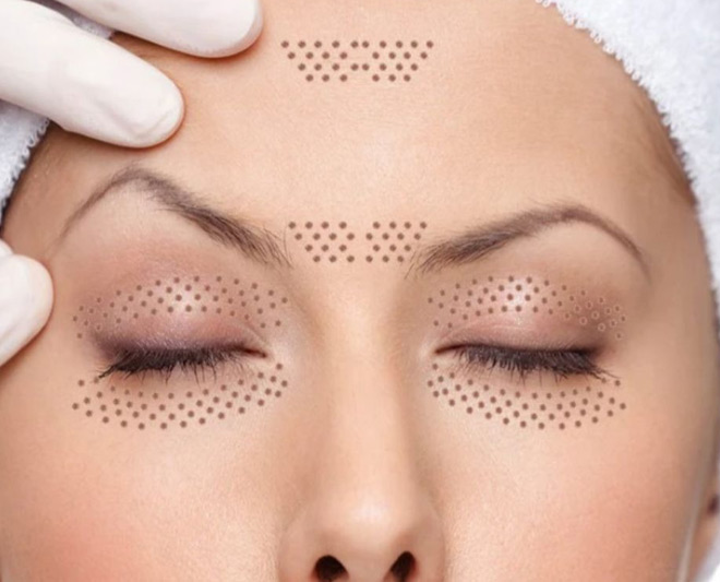 plasma eye lift