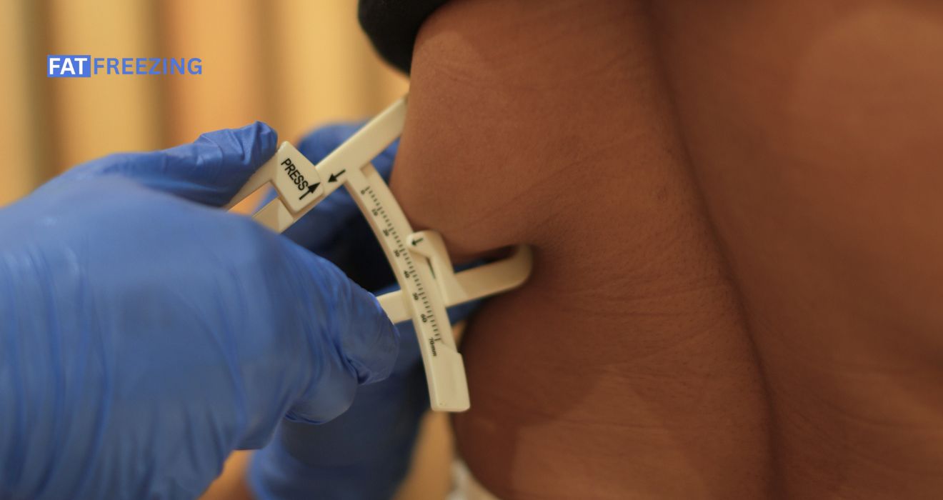 cryolipolysis for love handles