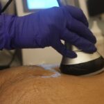 maintain weight loss after fat reduction