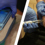 Is Fat Freezing Safe Compared injections